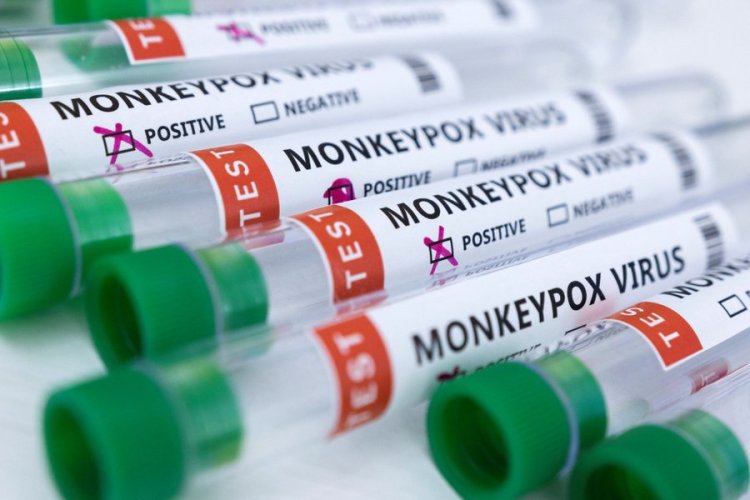 Monkeypox Virus Outbreak:मंकी पॉक्स का बढ़ रहा खौफ, जानिए क्या हैं इसके लक्षण और बचने के उपाय ?